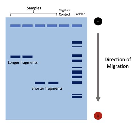 How to Read a Gel Image .